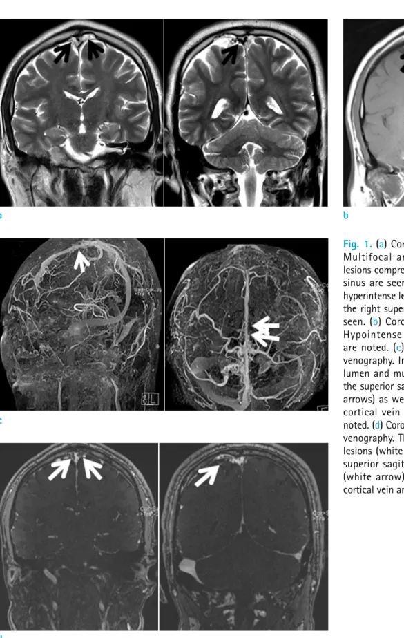 Fig. 1. (a) Coronal T2-weighted image. 