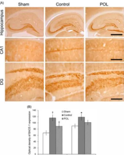 Fig.  12.  Representative  photographs  of  double-immunofluorescent  labeling  of  BACE1  and  APP  in  the  hippocampus