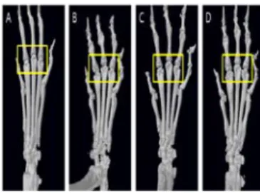 Fig.  7.  Micro-CT  images  of  hind  paws  of  CIA-induced  Rheumatoid  Arthritis  model  of  DBA/1  mice.