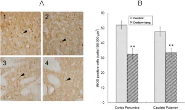 Fig.  5.  A  :  Representative  iNOS  immuno-labeled  brain  sections  of  hyperlipidemic  MCAO  rats  (1;  Control-cortex  penumbra,  2; 