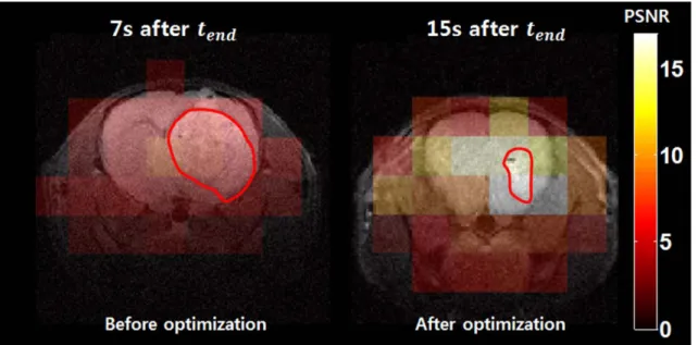 Fig. 3. Comparison of lactate map acquired at (a) control, 7 s after t end  and (b) optimized timing, 15 s after t end , overlaid  with  1 H anatomical image