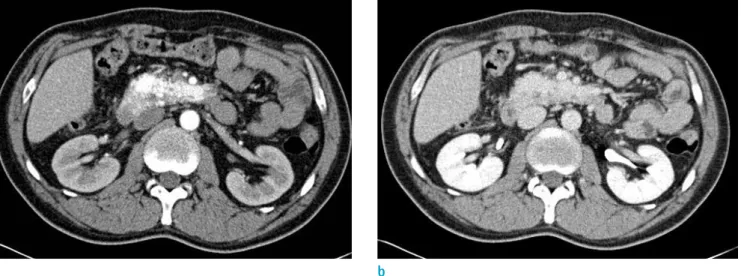 Table 1. MR Imaging Sequence and Parameters