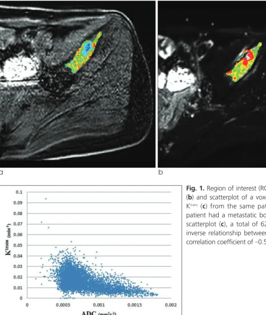 Fig. 1. Region of interest (ROI) drawn in K trans map (a), ADC map (b) and scatterplot of a voxel-by-voxel comparison of ADC and