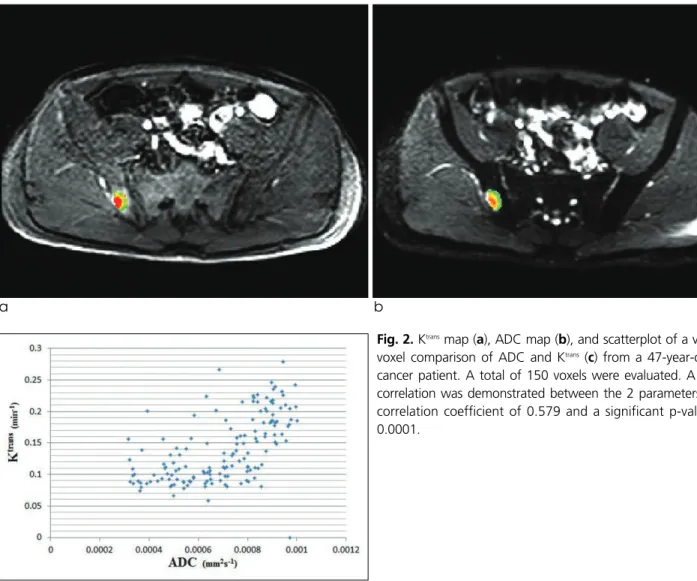 Fig. 2. K trans map (a), ADC map (b), and scatterplot of a voxel-by- voxel-by-voxel comparison of ADC and K trans (c) from a 47-year-old lung cancer patient