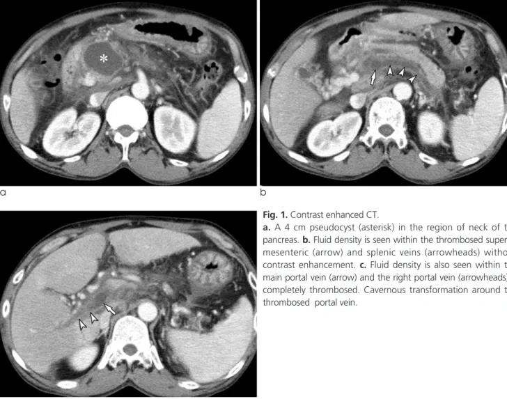 Fig. 1. Contrast enhanced CT. 