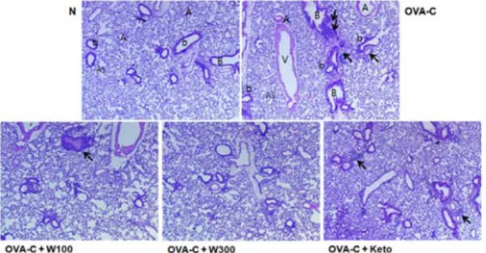 Fig  3.  Effect  of  JPR-W  extract  on  IFN-γ  levels  in  the  sera  of  OVA-induced  asthma  mice.