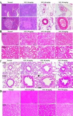Fig.  5.  The  morphological  changes  of  pancreas,  kidney,  lung  and  liver  tissues  in  STZ-induced  diabetic  rats
