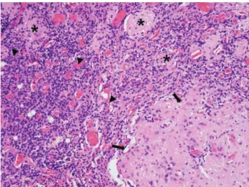 Fig. 1. The initial CT (a) study revealed a 15