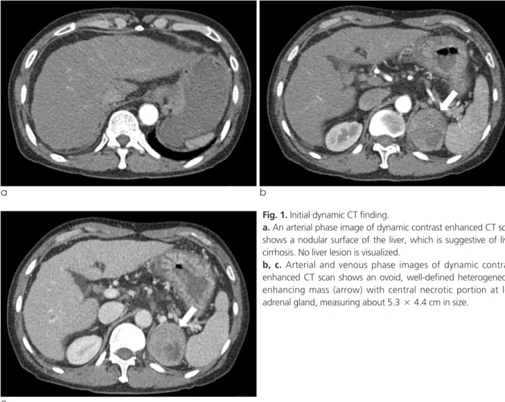 Fig. 1. Initial dynamic CT finding.