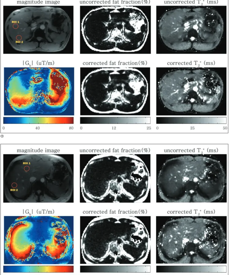 Fig. 5. Results from two healthy volunteers (a,  b) with a spatial resolution of 2.5 × 2.5  × 8.0 mm 3 