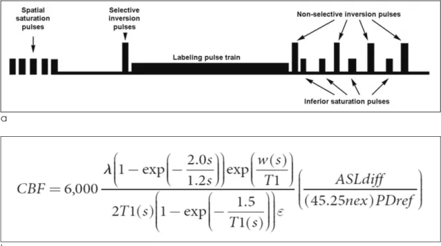 Fig. 1. a. The pre and post pulses provide background suppression necessary for better contrast