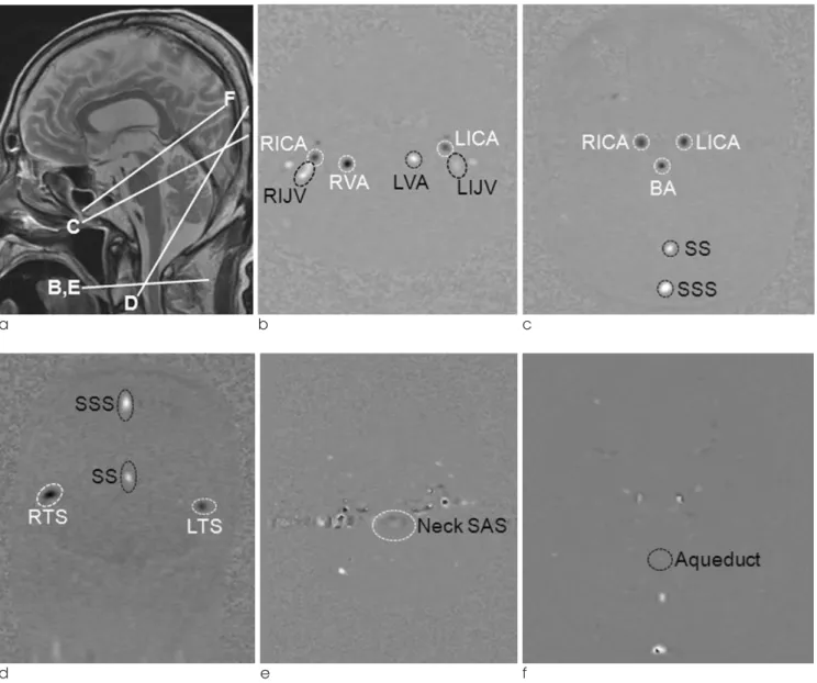 Fig. 1. Scanning protocol of 2D cine phase contrast MR imaging and data extraction. 