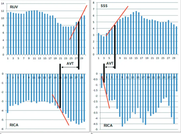 Fig. 2. Generation of time-volume curves and the definition of arteriovenous transit time (AVTT)