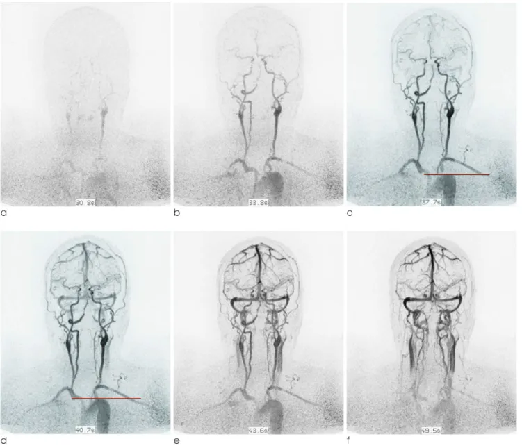 Fig. 1. a-f. serial images of dynamic 3D time-resolved contrast-enhanced MRA.