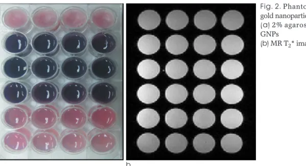 Fig. 2. Phantom and MR image of gold nanoparticles