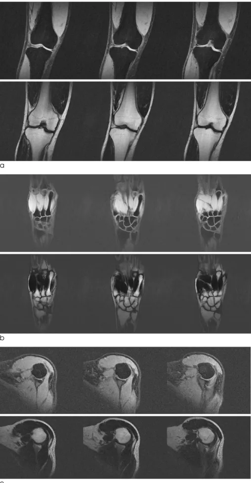 Fig. 8. In-vivo multi-slice water (top) and fat (bottom) images of knee (a), hand (b), and shoulder (c) of  volun-teers are shown