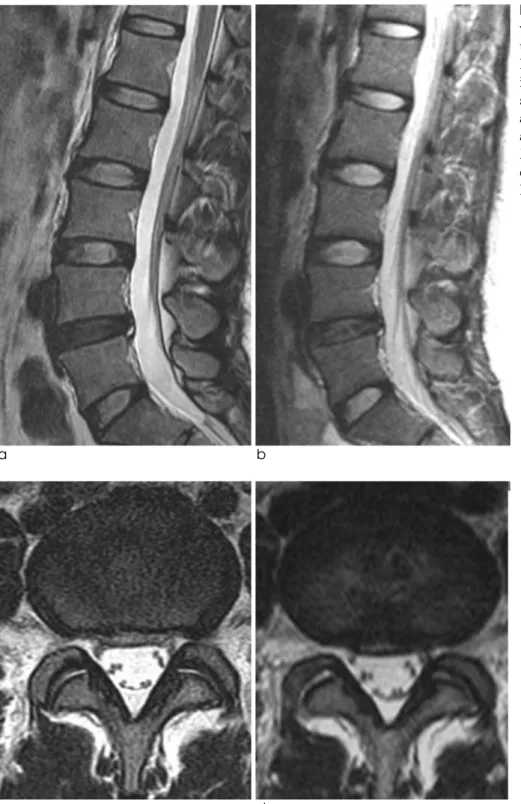 Fig. 1. A 29-year-old female under- under-went follow-up 47 months after  ini-tial presentation.