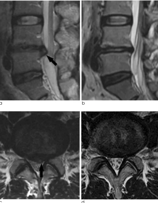 Fig. 3. A 46-year-old female under- under-went follow-up 6 months after initial presentation.