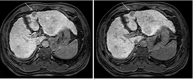 Fig. 6. A 77-year-old male with hepatic dysfunction