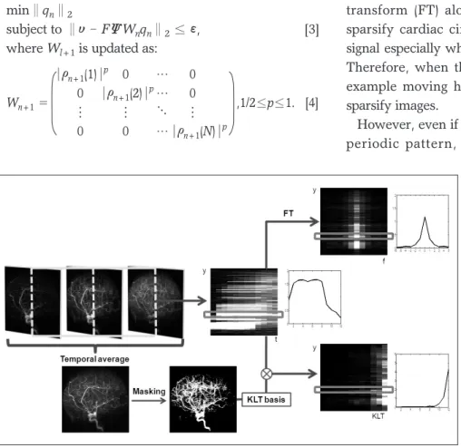 Fig.  1.  Time resolved CE-MRA can be spasified using FT or KLT. Unlike FT, KLT is data dependent transform so that KLT bases should be obtained from given data set