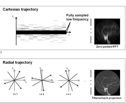 Fig. 2. Randomly sampled Cartesian and radial trajectories are illustrated with reconstructed images using conventional methods in (a) and (b), respectively.