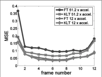 Fig.  3. Two different time frames representing spread of bolus are illustrated to compare the  perfor-mance of FT without up-sampling, FT with up-sampling, and KLT with up-sampling