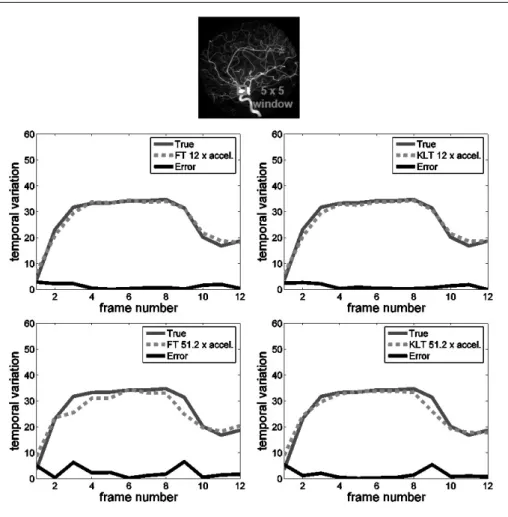Table 1. Comparison of various versions of k-t FOCUSS in terms of reconstruction time and MSE for each coil