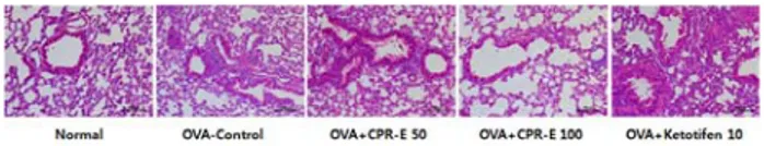 Fig  5.  Effect  of  CPR-E  on  OVA-induced  histopathological  changes  in  lung  tissue  of  mice