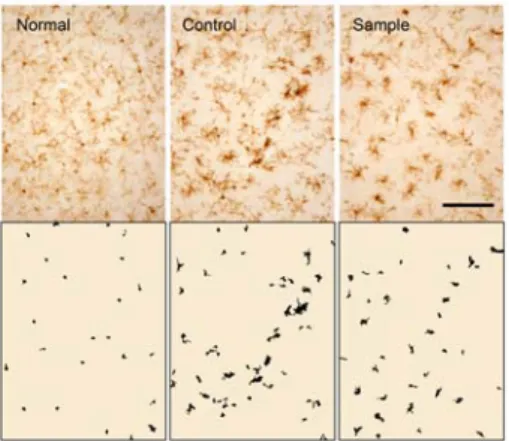 Fig.  11.  Representative  photographs  show  Iba1  immuno  -stained  microglia  in  the  hypothalamic  region  of  LPS-treated  mouse  brain