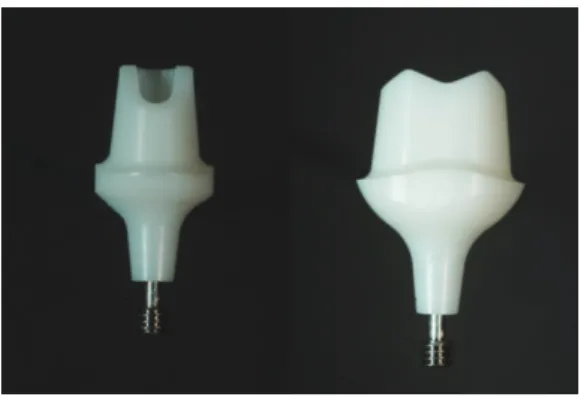 Fig. 1.  Prototype zirconia healing abutments were  designed and fabricated for the study