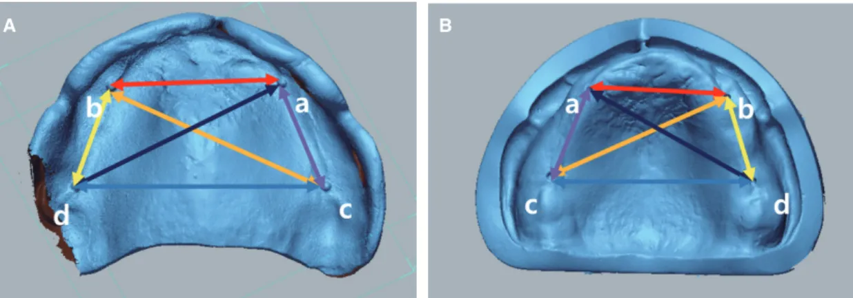 Fig. 7.  Process of overlaying denture base and cast,  sectioning. (A) Scanned STL files of denture base and  cast, (B) Four points selected for superimposition, (C)  Superimposed data and cross sectioning through 2nd  premolars and 2nd molars.