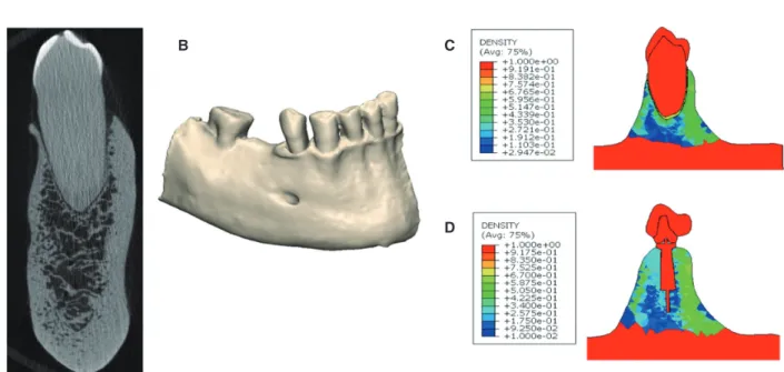 Fig. 6.  Micro-CT image of natural tooth from a cadaveric specimen (A), 3-dimensional reconstruction of entire rightside of  the mandible from micro-CT images (B), and resulting density map for the natural tooth (C) and prosthetic tooth (D)