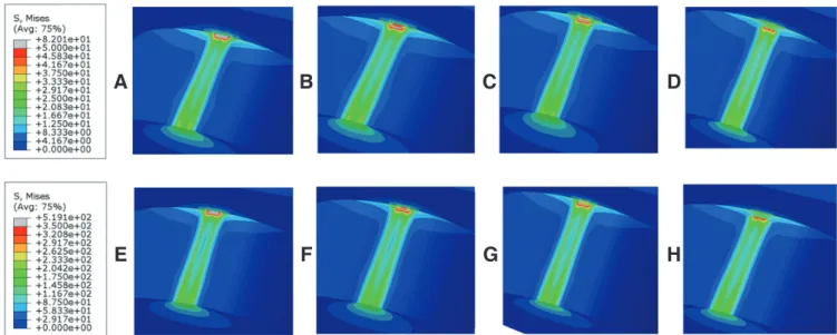 Fig. 3.  Sectional views of von Mises stress of the finite element model simulating the shear bond test