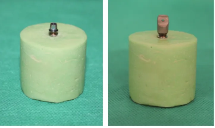 Fig. 2.  CAD/CAM metal  coping with occlusal loop.