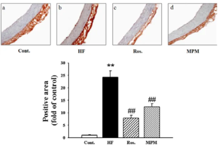 Fig.  5.  Effect  of  MPM  on  ET-1  expression  in  the  aorta  of  fructose-diet  rats