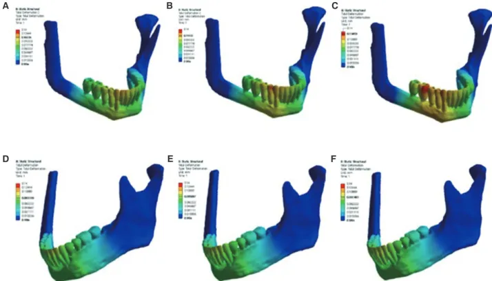 Fig. 7.  The displacement tendency on each model. (A) FB1, (B) FB2, (C) FB3, (D) MN1, (E) MN2, (F) MN3.