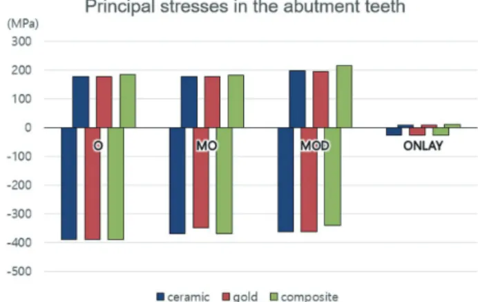 Fig. 9.  Maximum and minimum principal stresses gener- gener-ated in the abutment teeth with various dental materials