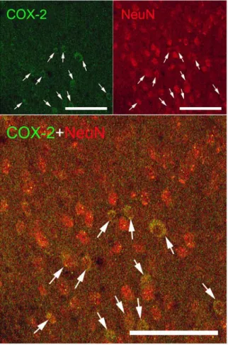 Fig.  5.  Representative  photographs  showing  double-immunofluorescent  labeling  against  COX-2  and  NeuN  in  the  brain  tissue
