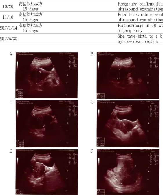 Fig. 2. Progress of sonography.