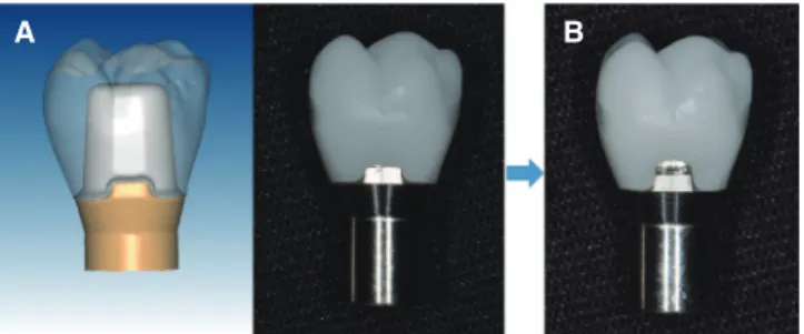Fig. 4.  The custom-made device used for measuring  removal torque in this experiment.