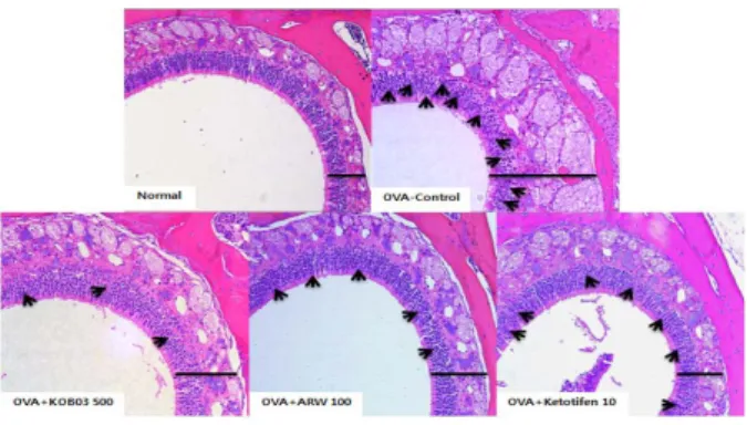 Fig  5.  Effect  of  KOB  and  Astragali  Radix  extract  on  histological  changes  of  nasal  mucosa  in  OVA-induced  allergic  rhinitis  mice