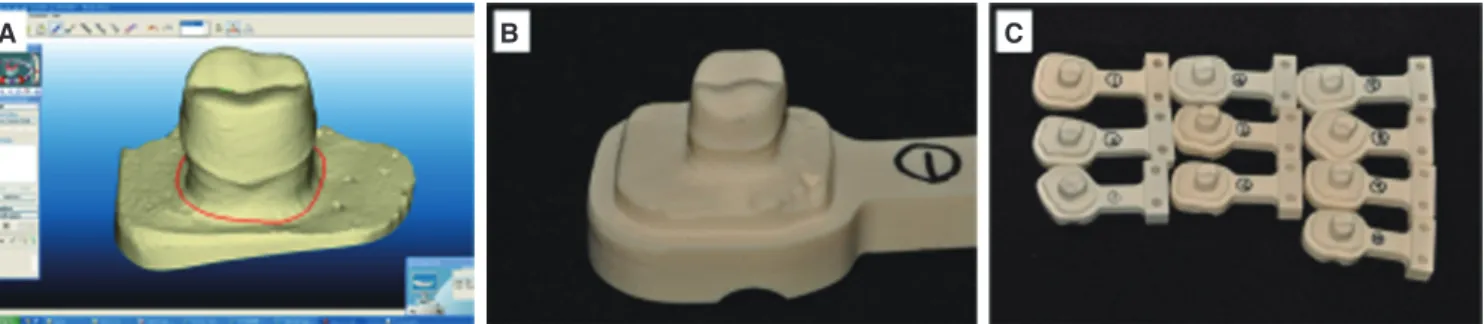 Fig. 4.  Using (A) the digital impression technique (B and C) polyurethane models fabricated in a master model.
