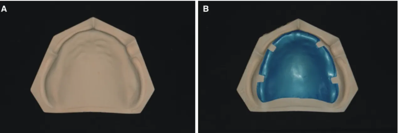 Fig. 1.  (A) Maxillary edentulous master cast, (B) 0.5 mm relief on cast.