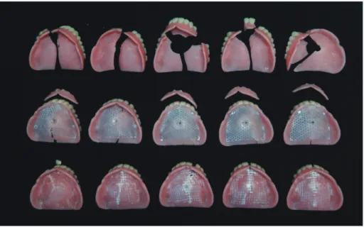 Fig. 4.  Representative fracture patterns of complete dentures. Upper: resin complete dentures, Middle: metal mesh- mesh-reinforced complete dentures, Lower: fiber mesh-mesh-reinforced complete dentures.