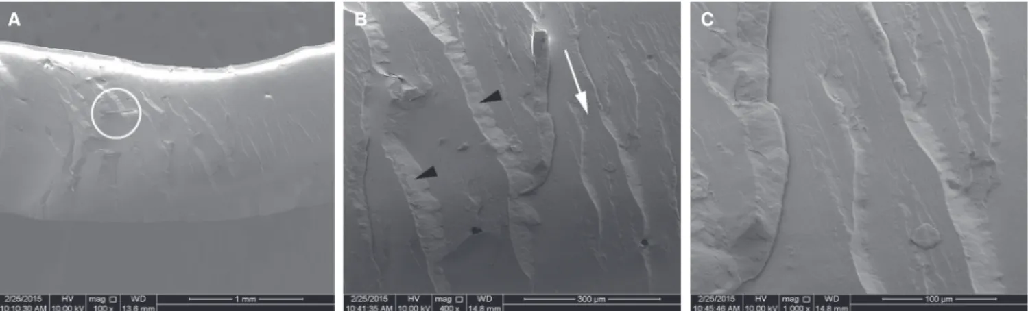 Fig. 6.  Fractured surface of the metal mesh-reinforced complete denture; palate area of acrylic resin base