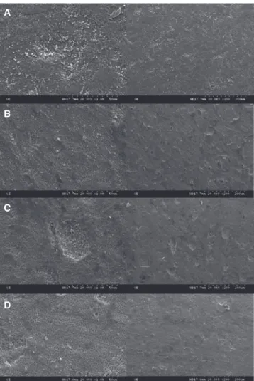 Fig. 2.  (A) SEM image of zirconia surface after HF  etching (×1000, ×200), (B) Zircos E 1-hour etching  (×1000, ×200), (C) 2-hour etching (×1000, ×200), (D)  3-hour etching (×1000, ×200)