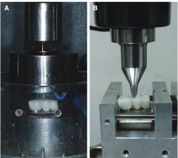 Fig. 4.  Preparation of the test set-up. (A) Repetitive  preloading in a chewing simulator, (B) Fracture load test  in a universal testing machine.