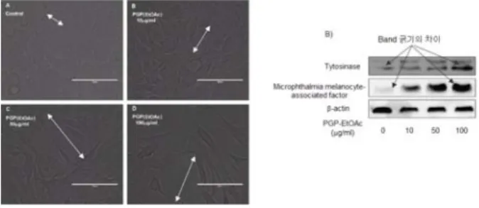 Fig.  11.  Effect  of  PGP  EtOAc  extract  on  morphological  changes  of  B16F10  melanoma  cells(A),  on  the  tyrosinase  and  MITF  protein  expressions  in  B16F10  melanoma  cells(B)