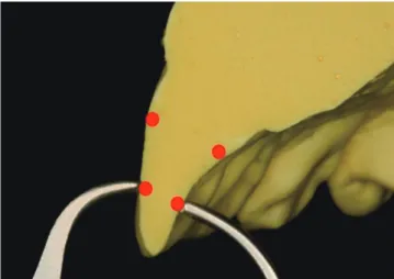 Fig. 2.  The thickness of anterior incisors was measured at  the border between the middle 1/3 and the incisal 1/3.