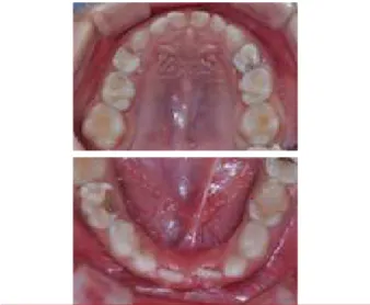 Fig.  1.  Intra-oral  state  before  the  dental  treatment.교합, 치주 질환 및 치아 우식의 증가 등이 관찰될 수 있다[1,2]